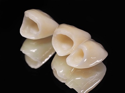 かぶせ物