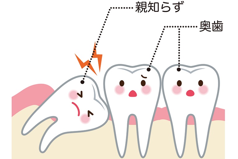 芦屋で親知らずの抜歯ならBio Dental Clinic ASHIYA